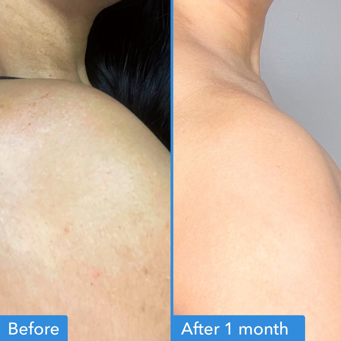 discoloration-correcting-body-treatment-r2 zb_p.jpg