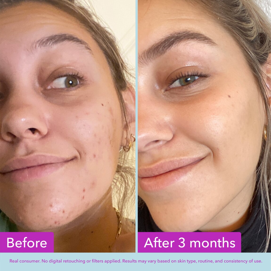 niacinamide-brightening-toner-c0 zb_p.jpg